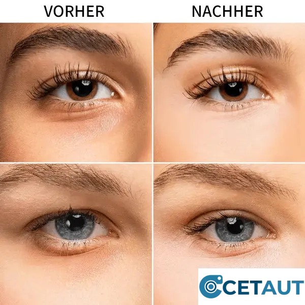 💖Augenaufheller, dunkle Augenringe abdecken und aufhellen cetaut